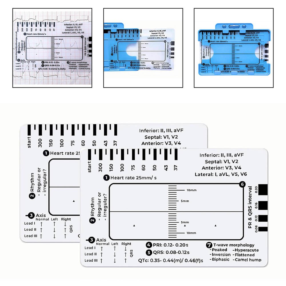 Comprehensive ECG Ruler Featuring 7 Steps for Simplified Data Interpretation