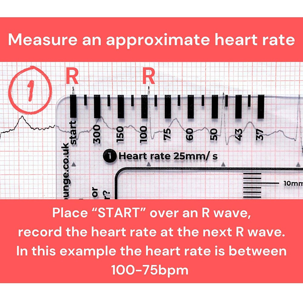 Comprehensive ECG Ruler Featuring 7 Steps for Simplified Data Interpretation