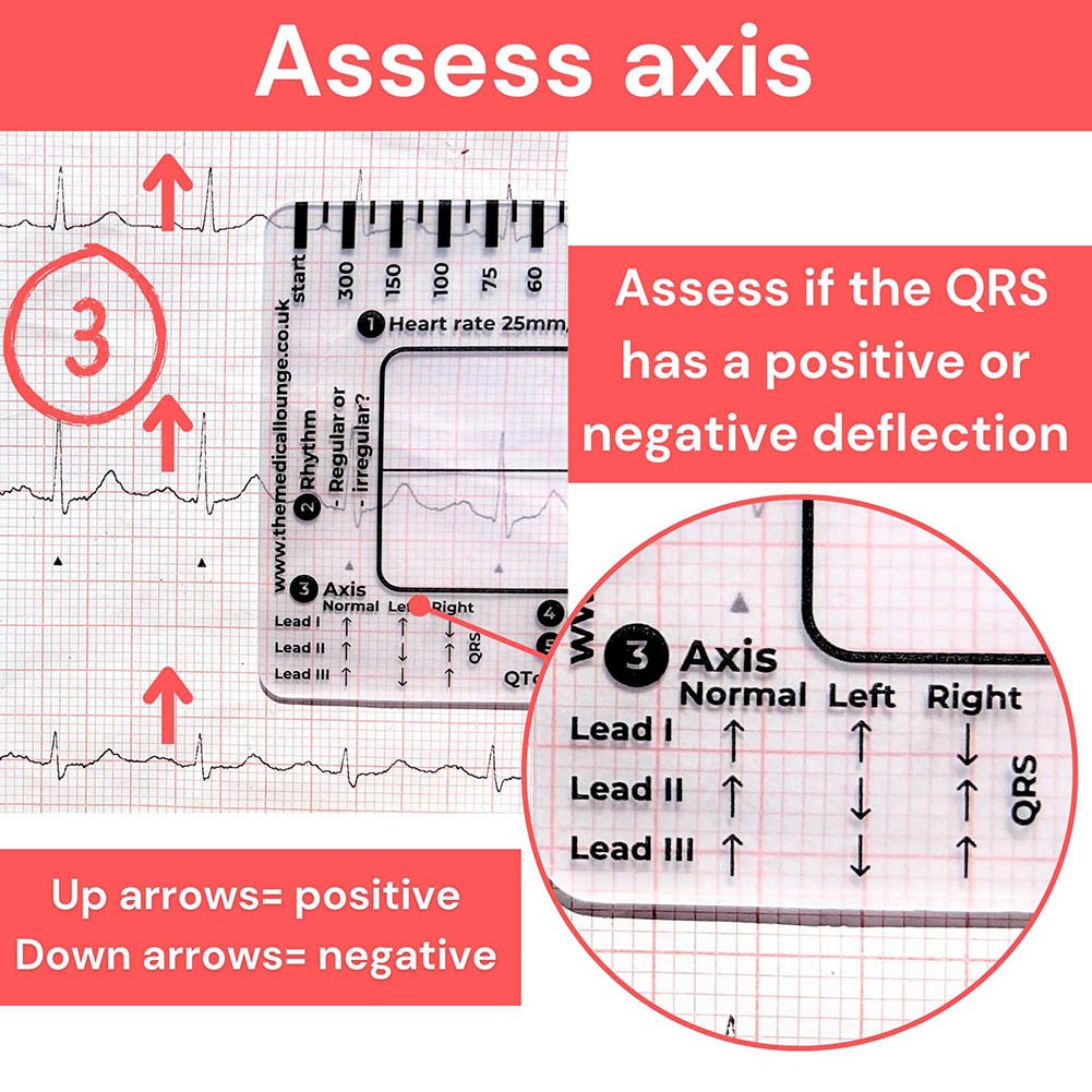 Comprehensive ECG Ruler Featuring 7 Steps for Simplified Data Interpretation