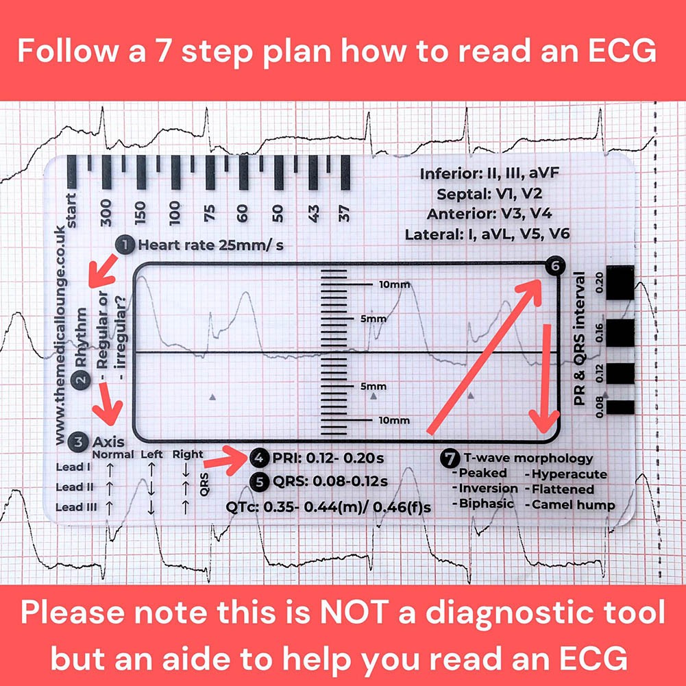 Comprehensive ECG Ruler Featuring 7 Steps for Simplified Data Interpretation